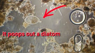 Frontonia poops out a diatom  100x [upl. by Aciras134]