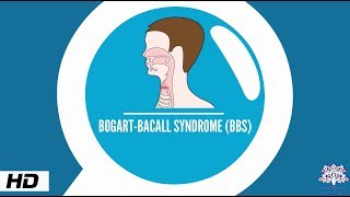 Bogart–Bacall syndrome Causes Signs and Symptoms Diagnosis and Treatment [upl. by Daisey]