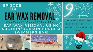 EAR WAX REMOVAL USING SUCTIONJOBSON HORNE amp SWIMMERS EAR  EP410 [upl. by Niarb]