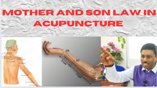 MOTHER AND SON LAW IN ACUPUNCTURE [upl. by Ayoral]