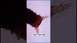 Butterfly larva under microscope 🔬 ytshorts shorts microscope butterfly viralvideo [upl. by Niawat]