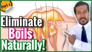 5 Natural Ways to Get Rid of Boils  Treat a Boil at Home FAST [upl. by Danna372]