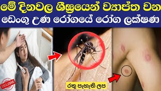 ඩෙංගු උණ රෝගයේ රෝග ලක්ෂණ  Dengue roga lakshana  Symptoms of dengue fever sinhala  Dengue una [upl. by Orbadiah]