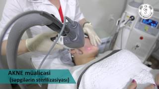 AKNE müalicəsi səpgilərin sterilizasiyası [upl. by Farny]