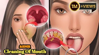 ASMR 3d doctor animation mouth 👄 😺 cleaning  The Cleaning of skin and mouth asmranimation [upl. by Notnarb]