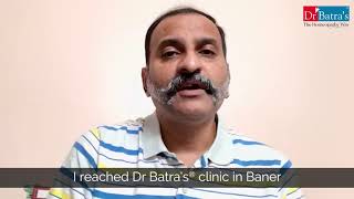 Homeopathy Heals Hair Treatment Results  Dr Batra’s Hair Loss Treatment Reviews [upl. by Iru]