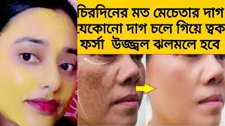 আলুর সাথে একটি জিনিস মিশিয়ে মাখো ত্বক দুধেরমত ফর্সাহবে Spotless glowing skinremove pigmentation [upl. by Malilliw]