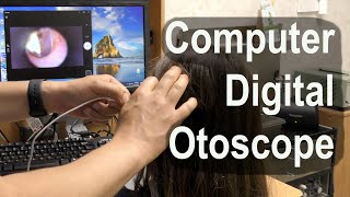 Computer Digital Otoscope for Home or Medical Office [upl. by Vail]