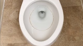 Recurring Toilet Ring  Top 3 Solutions tested  Problem Solved [upl. by Tiersten]