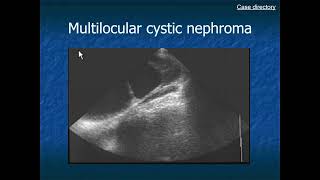 RADIOLOGY EXAM CASES [upl. by Kedezihclem]