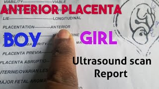 Anterior Placenta Baby GenderUltrasound Scan Report [upl. by Ysor]