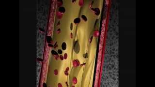 vidéo sur la formation dune thrombose [upl. by Linnie628]