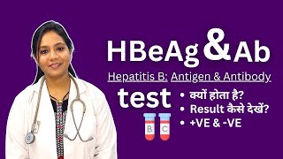 HBeAg and Antibodies Test in Hindi  Positive Negative Result Analysis [upl. by Spragens]