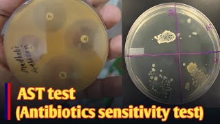 Antibiotic Sensitivity Testing Kirby Bauer Disc Diffusion Method vetzone nepal [upl. by Anaujnas853]