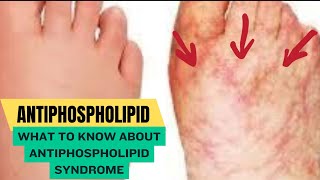 Antiphospholipid Syndrome [upl. by Erlewine]