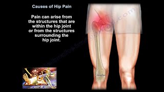 hip pain causes diagnosis and treatment [upl. by Heiner]