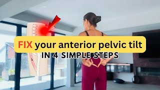 Fix your anterior pelvic tilt in 4 simple steps [upl. by Duquette677]