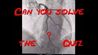 What are the Patient´s problems Echocardiography and Coronary angiogram Quiz by Cardiology Forum [upl. by Uund]