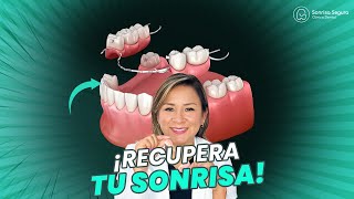 ¡Descubre el Secreto de la Prótesis Dental Removible [upl. by Imalda]