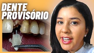 Dente provisório DESCUBRA como o DENTISTA faz um dente provisório da frente [upl. by Swithin]