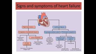 treatment of Congestive heart failure part 1 2024 [upl. by Assirahs142]