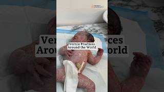 VERNIX Practices Around The 🌎 SO MUCH DISAGREEMENT OVER THIS [upl. by Medea]