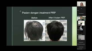 Integrative Care for Telogen Effluvium Rambut Rontok amp Alopecia Areata 2 [upl. by Ellerahs]