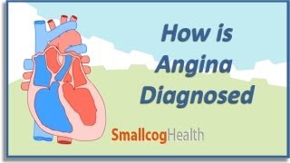 How is Angina Diagnosed [upl. by Tohcnarf]