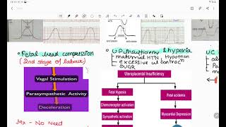 cardiotocography with mnemonicsctghindi nd englishdr c bravadosinusoidal wave pattern [upl. by Doroteya40]