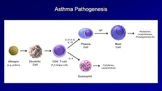 Asthma and COPD  Pathogenesis and Pathophysiology [upl. by Kellyann]