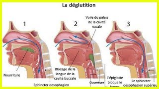 Que faire lors d’un étouffement  la manoeuvre de Heimlich [upl. by Rosenberger]