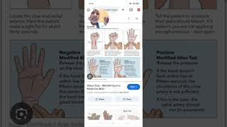 Allens test in Tamil  Anesthesia technology Radial artery cannulation Anesthesia procedure [upl. by Llehcear55]