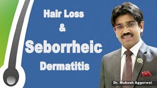 Hair Loss amp Seborrheic Dermatitis । भारत में हर वर्ष एक करोड़ लोग होते है परेशान ।Dr Mukesh Aggarwal [upl. by Carolan639]