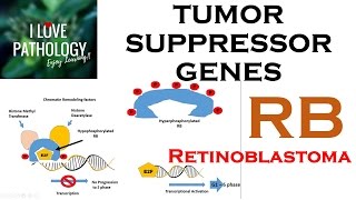 NEOPLASIA 3 TUMOR SUPPRESSOR GENES Retinoblastoma Gene Knudsons Two Hit Hypothesis [upl. by Lytsirhc964]