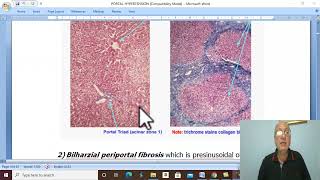 Hepatic disorders in Arabic 2  Portal hypertension  part 1  by Dr Wahdan [upl. by Accber]