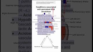 Conditions associated with persistent fetal circulation [upl. by Michell]