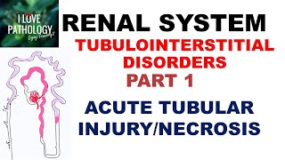 ACUTE TUBULAR INJURYNECROSIS or ACUTE KIDNEY INJURY  Pathology [upl. by Atiuqehc630]