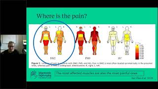 AsktheExpert Myotonic Dystrophy Type 2 amp Pain Management [upl. by Bathesda86]