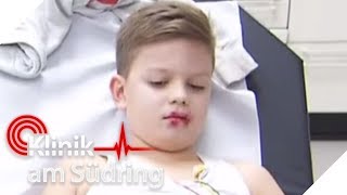 Kinder 8 essen Rattengift Jetzt droht die innere Verblutung  Klinik am Südring  SAT1 TV [upl. by Nohsid]