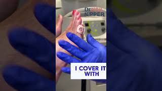 5th Toe Corn Pad  and debridement  Part 2 CornPad Debridement drnailnipper [upl. by Ailimat]