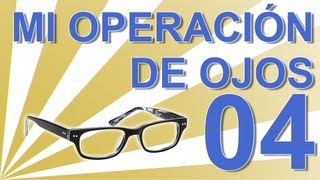 RECUPERACIÓN Y CONSEJOS  Operación ojos con lentillas intraoculares Experiencia personal C04 [upl. by Eeslehc853]