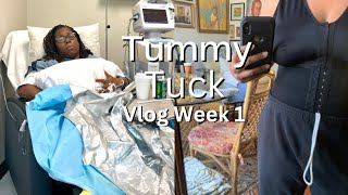 Tummy Tuck Vlog Week One [upl. by Roye830]