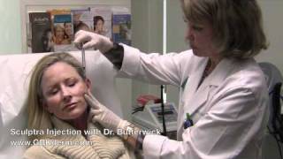 San Diego Sculptra Treatment With Dermatologist Dr Butterwick In La Jolla [upl. by Eenal]