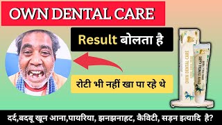 Result बोलता है 🔥 दांत दर्द से परेशान  Best Toothpaste  Dental Care Formula aownworld [upl. by Oal40]