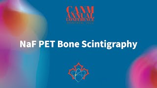 NaF PET Bone Scintigraphy [upl. by Zubkoff]