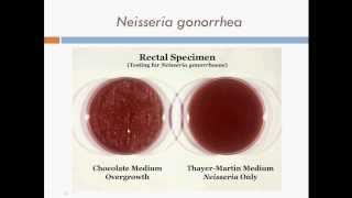 Bacteriology Diplococcus Gram Negative Cocci [upl. by Matheny]