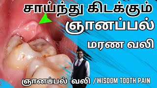 ஞானப்பல் வலி குறைய2024𝐖𝐢𝐬𝐝𝐨𝐦 𝐭𝐨𝐨𝐭𝐡 𝐏𝐚𝐢𝐧 𝐢𝐧 𝐓𝐚𝐦𝐢𝐥Tooth pain relief in tamilkadava pallu pain [upl. by Rosanna982]