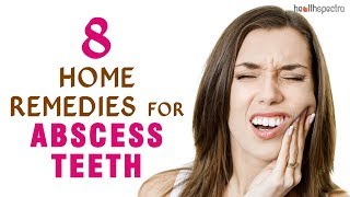 8 Home Remedies for Abscess Teeth [upl. by Ezri]