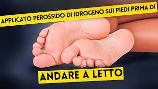 Ecco Cosa è Successo Dopo Solo 2 Volte Perossido di Idrogeno sui Piedi [upl. by Harihs]