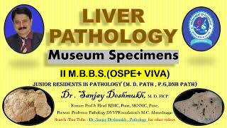 Pathology practical Liver Specimens Dr Sanjay D Deshmukh MD FICP Rapid Revision Pathology [upl. by Andromache]